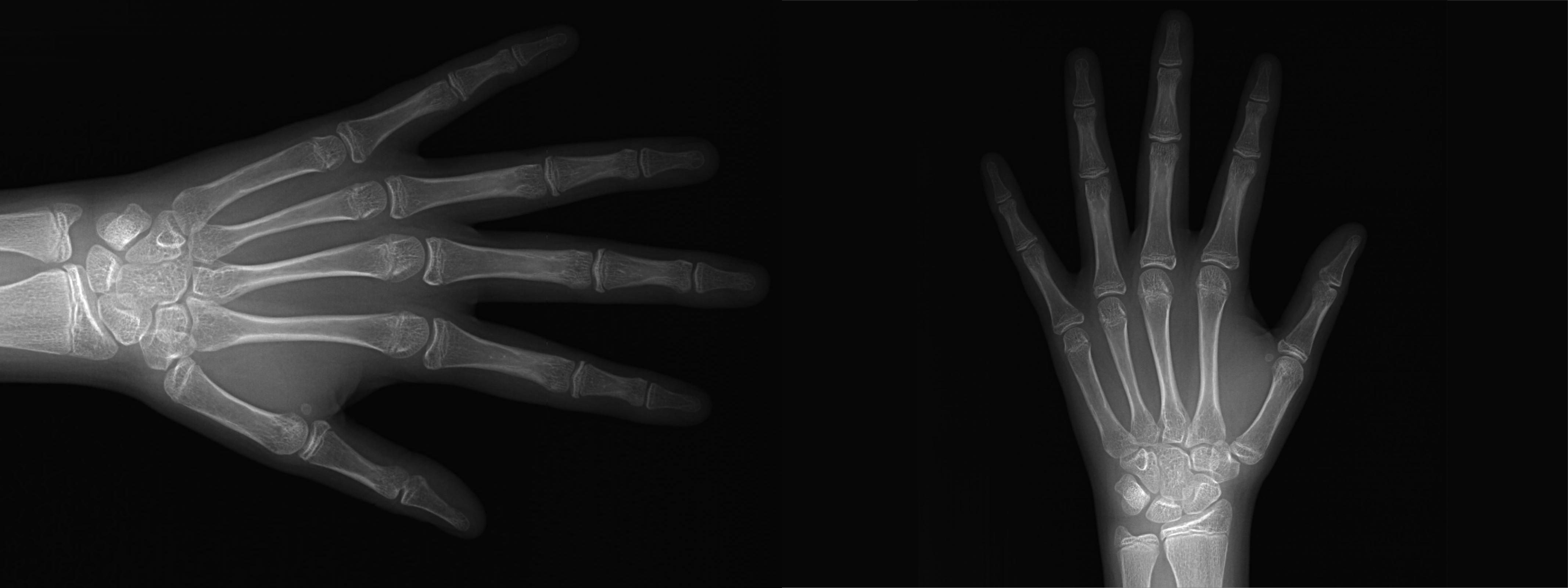 Radiografía Intrabucal